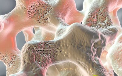 Osteoporose: Guia Completo Sobre Causas e Tratamentos